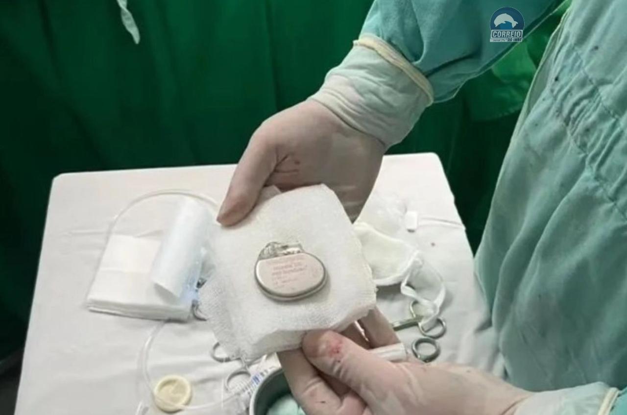 Hospital São Vicente de Paulo realiza primeiro implante de marcapasso transcutâneo no Litoral Norte