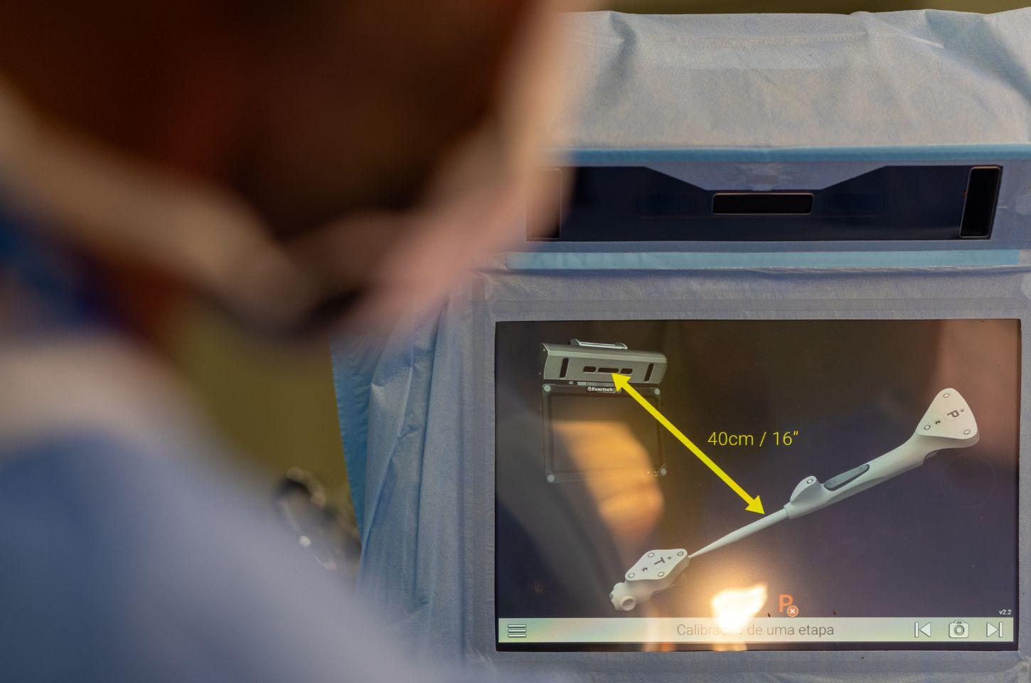 Hospital Moinhos de Vento utiliza GPS em cirurgia de prótese de ombro