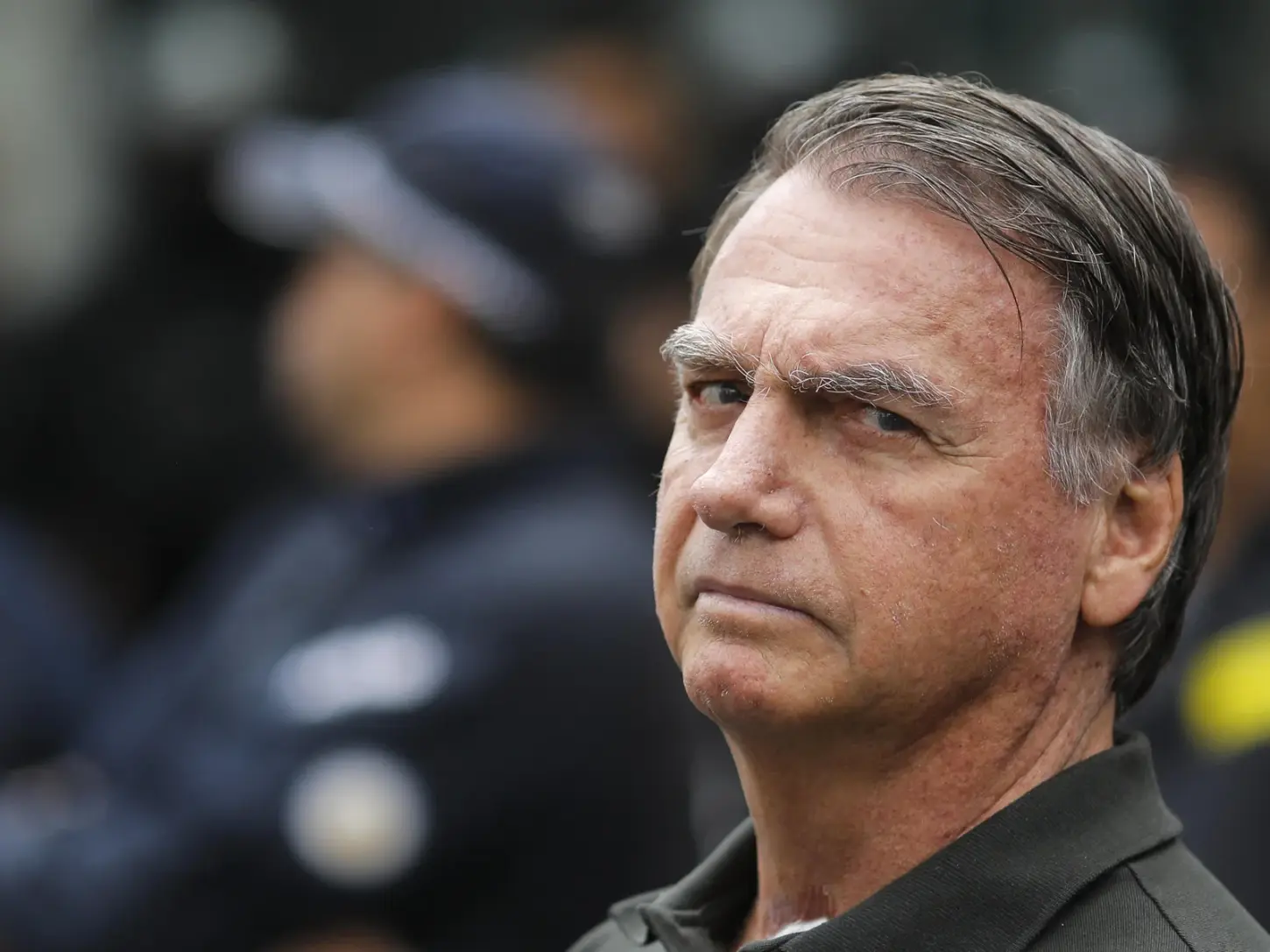 Ex-presidente tem piora na função renal e aumento de inflamação, diz boletim médico