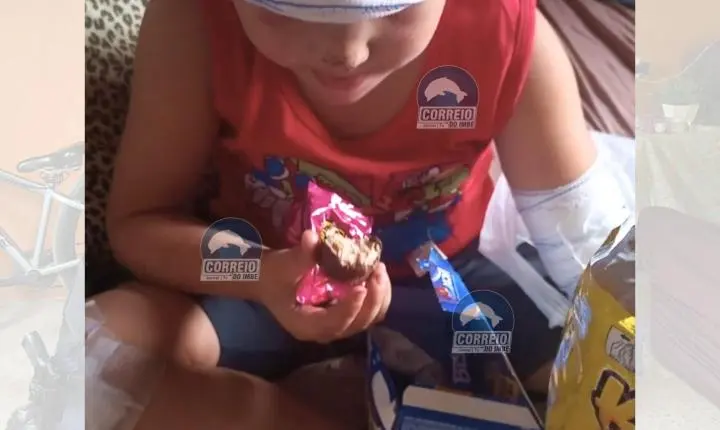 Após atropelamento por cavalo, criança de 5 anos recebe visita e presentes de Páscoa da Guarda Municipal em Tramandaí